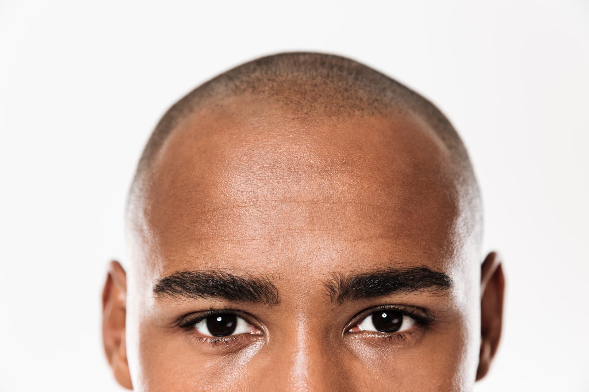 A close-up of a young man with a closely cropped hairline